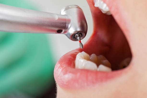 Best Chipped Tooth Repair Near Me  in Danbury, TX